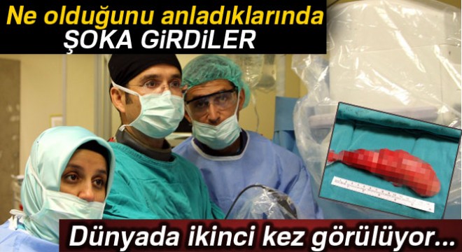 Bu kanser türüne dünyada ikinci kez Samsun da rastlandı